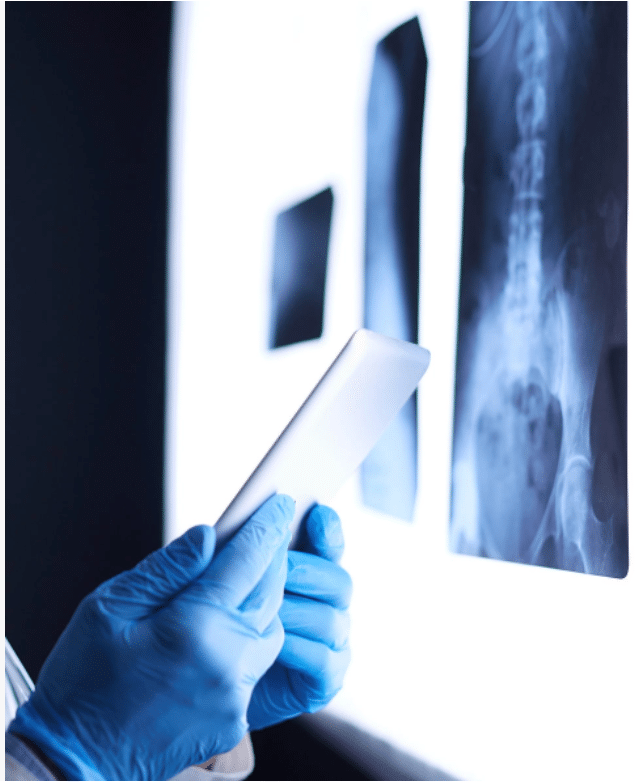 Spinal Cord Injury Lawyers